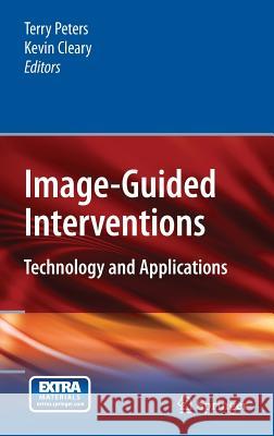 Image-Guided Interventions: Technology and Applications Peters, Terry 9780387738567 Springer - książka