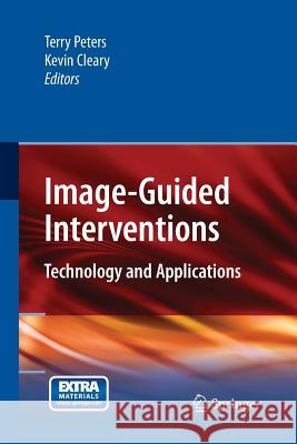 Image-Guided Interventions: Technology and Applications Peters, Terry 9781489997333 Springer - książka