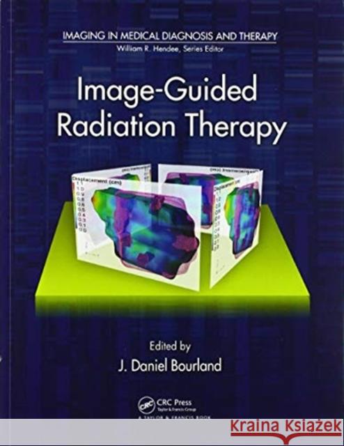 Image-Guided Radiation Therapy J. Daniel Bourland 9780367576783 CRC Press - książka