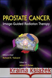 Image-Guided Radiation Therapy of Prostate Cancer Richard K. Valicenti Adam P. Dicker David A. Jaffray 9781420060782 Informa Healthcare - książka