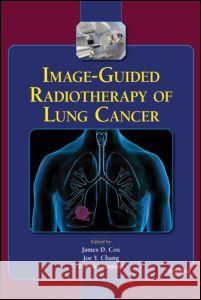 Image-Guided Radiotherapy of Lung Cancer James D. Cox James D. Cox Joe Y. Chang 9780849387838 Informa Healthcare - książka