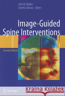 Image-Guided Spine Interventions John Mathis Stanley Golovac 9781461405252 Springer - książka