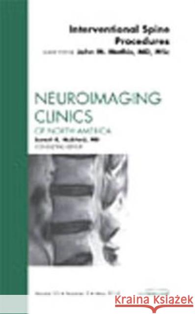 Image-Guided Spine Interventions, An Issue of Neuroimaging Clinics Mathis, John M. 9781437722710 Saunders - książka