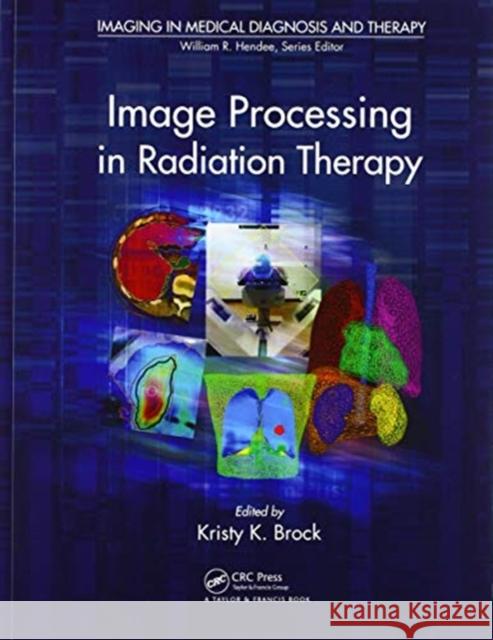 Image Processing in Radiation Therapy Kristy K. Brock 9780367576356 CRC Press - książka