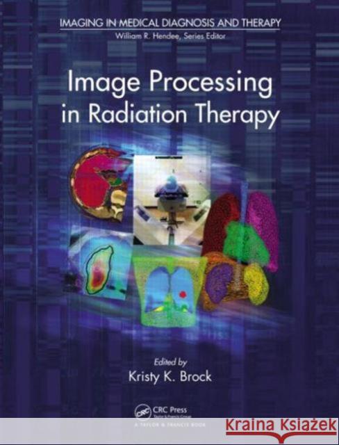 Image Processing in Radiation Therapy Kristy Kay Brock 9781439830178 CRC Press - książka