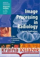 Image Processing in Radiology: Current Applications Neri, Emanuele 9783540259152 Springer - książka