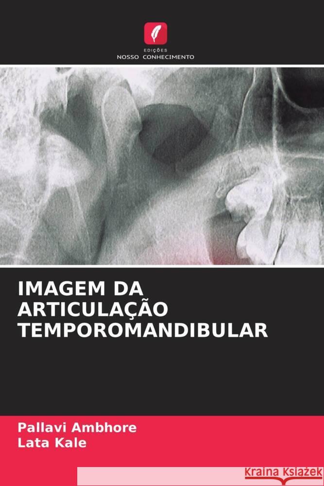 IMAGEM DA ARTICULAÇÃO TEMPOROMANDIBULAR Ambhore, Pallavi, Kale, Lata 9786204636634 Edições Nosso Conhecimento - książka