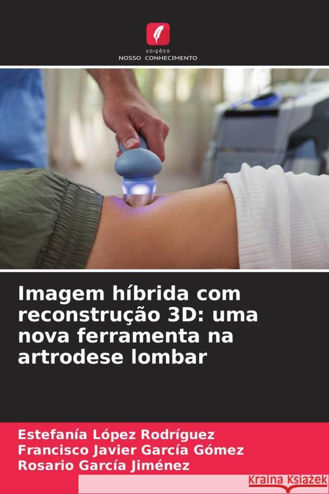 Imagem híbrida com reconstrução 3D: uma nova ferramenta na artrodese lombar López Rodríguez, Estefanía, García Gómez, Francisco Javier, García Jiménez, Rosario 9786209684333 Edições Nosso Conhecimento - książka