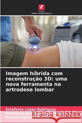 Imagem híbrida com reconstrução 3D: uma nova ferramenta na artrodese lombar López Rodríguez, Estefanía, García Gómez, Francisco Javier, García Jiménez, Rosario 9786209684333 Edições Nosso Conhecimento - książka
