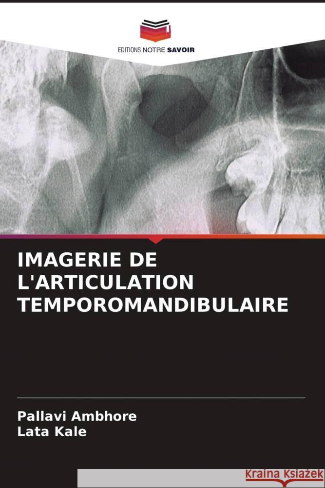 IMAGERIE DE L'ARTICULATION TEMPOROMANDIBULAIRE Ambhore, Pallavi, Kale, Lata 9786204636603 Editions Notre Savoir - książka