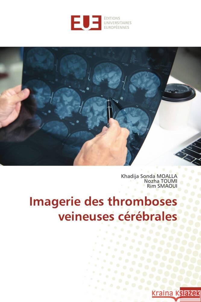 Imagerie des thromboses veineuses c?r?brales Khadija Sonda Moalla Nozha Toumi Rim Smaoui 9786206726111 Editions Universitaires Europeennes - książka