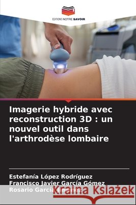 Imagerie hybride avec reconstruction 3D: un nouvel outil dans l'arthrod?se lombaire Estefan?a L?pe Francisco Javier Garc? Rosario Garc? 9786209676659 Editions Notre Savoir - książka
