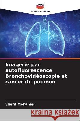 Imagerie par autofluorescence Bronchovid?oscopie et cancer du poumon Sherif Mohamed 9786205696033 Editions Notre Savoir - książka