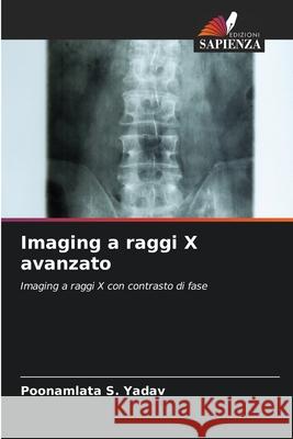 Imaging a raggi X avanzato Poonamlata S. Yadav 9786207576661 Edizioni Sapienza - książka