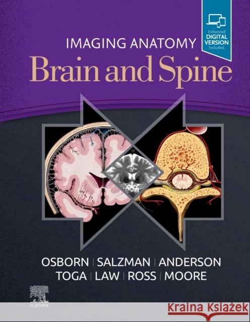 Imaging Anatomy Brain and Spine Anne G. Osborn Karen L. Salzman Jeffrey S. Anderson 9780323661140 Elsevier - książka