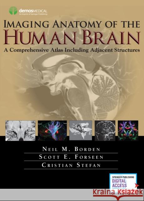 Imaging Anatomy of the Human Brain: A Comprehensive Atlas Including Adjacent Structures Neil M. Borden 9781936287741 Demos Medical Publishing - książka