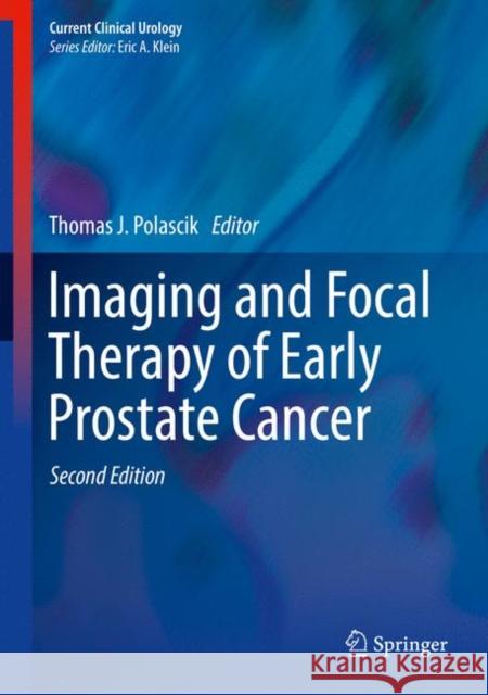 Imaging and Focal Therapy of Early Prostate Cancer Thomas J. Polascik 9783319499109 Springer - książka