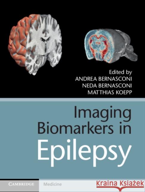 Imaging Biomarkers in Epilepsy Andrea Bernasconi Neda Bernasconi Matthias Koepp 9781107108356 Cambridge University Press - książka