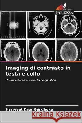 Imaging di contrasto in testa e collo Harpreet Kaur Gandhoke 9786204497068 Edizioni Sapienza - książka