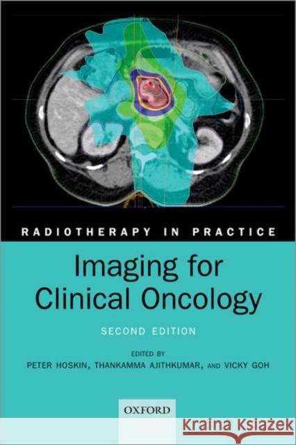Imaging for Clinical Oncology Peter Hoskin Thankamma Ajithkumar Vicky Goh 9780198818502 Oxford University Press, USA - książka