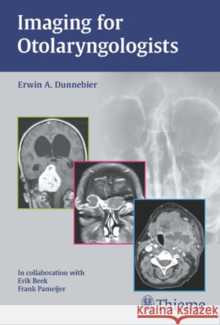 Imaging for Otolaryngologists Dunnebier, Erwin A. 9783131463319  - książka
