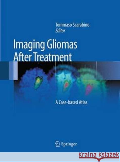 Imaging Gliomas After Treatment: A Case-Based Atlas Scarabino, Tommaso 9788847058262 Springer - książka