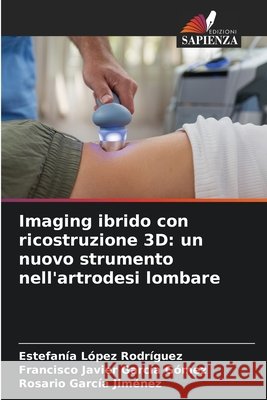 Imaging ibrido con ricostruzione 3D: un nuovo strumento nell'artrodesi lombare López Rodríguez, Estefanía, García Gómez, Francisco Javier, García Jiménez, Rosario 9786209681776 Edizioni Sapienza - książka