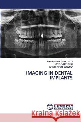 IMAGING IN DENTAL IMPLANTS NALLI, PRASANTH KUMAR, Koduri, Sridevi, Buduru, Krishnaveni 9786206151302 LAP Lambert Academic Publishing - książka