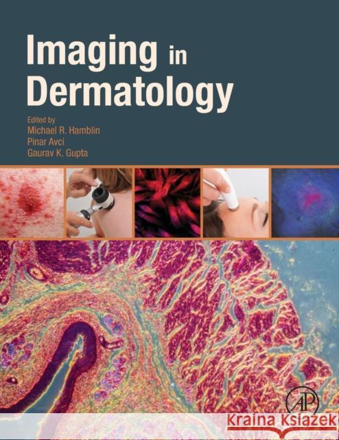 Imaging in Dermatology Michael Hamblin 9780128028384 ACADEMIC PRESS - książka