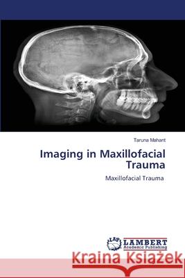 Imaging in Maxillofacial Trauma Mahant, Taruna 9786208447229 LAP Lambert Academic Publishing - książka