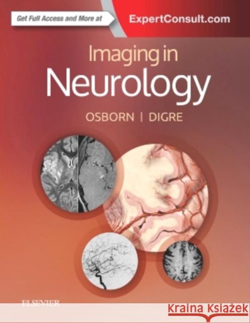 Imaging in Neurology Anne G. Osborn Kathleen B. Digre 9780323447812 Amirsys - książka