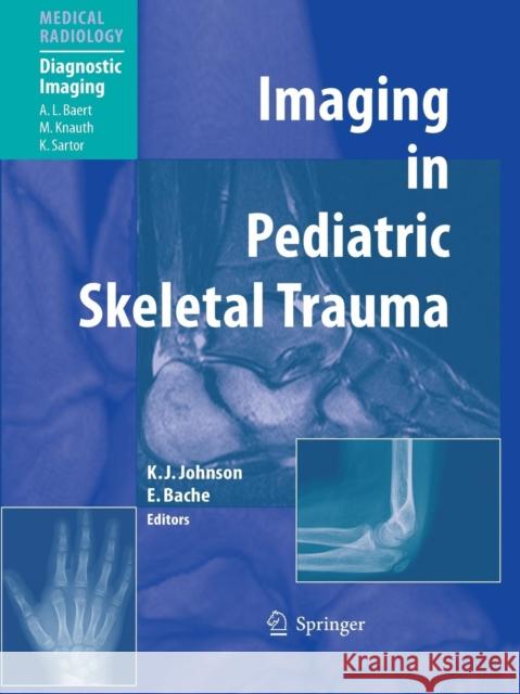 Imaging in Pediatric Skeletal Trauma: Techniques and Applications Johnson, Karl J. 9783642085451 Not Avail - książka