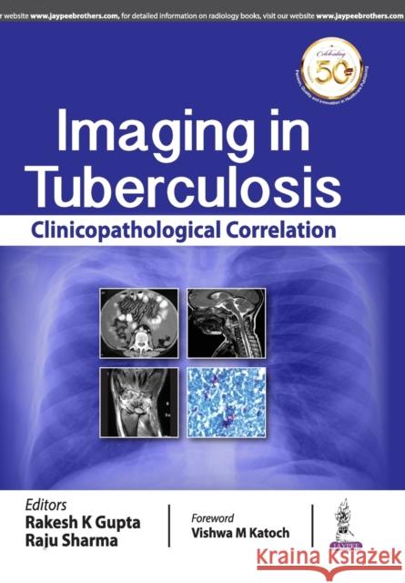 Imaging in Tuberculosis: Clinicopathological Correlation Rakesh K Gupta Raju Sharma  9789388958974 Jaypee Brothers Medical Publishers - książka