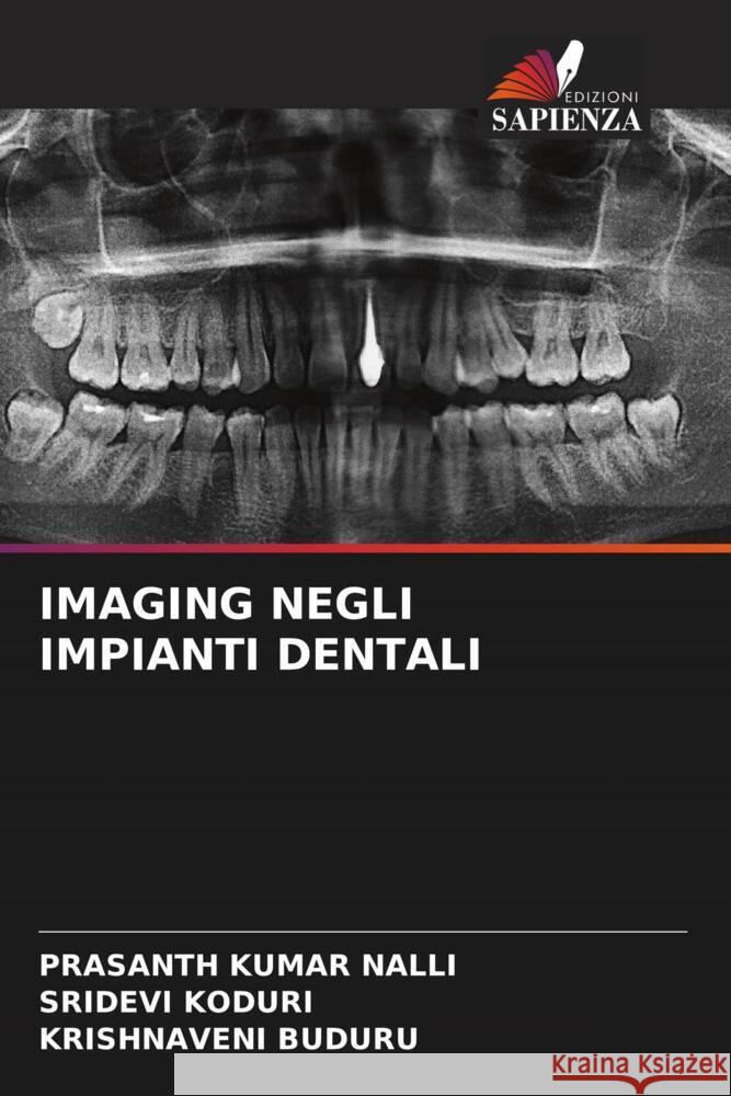 Imaging Negli Impianti Dentali Prasanth Kumar Nalli Sridevi Koduri Krishnaveni Buduru 9786207204304 Edizioni Sapienza - książka