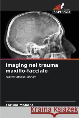 Imaging nel trauma maxillo-facciale Mahant, Taruna 9786209271779 Edizioni Sapienza - książka