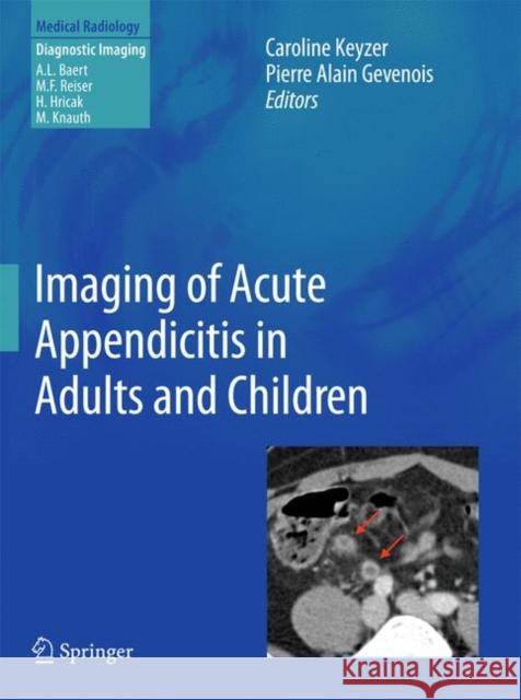 Imaging of Acute Appendicitis in Adults and Children  9783642178719 Springer, Berlin - książka