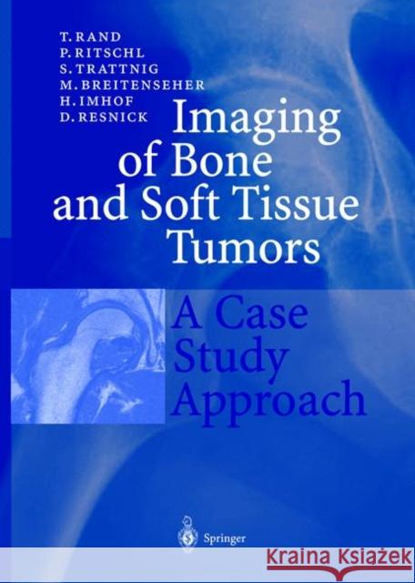 Imaging of Bone and Soft Tissue Tumors: A Case Study Approach Rand, T. 9783540650966 Springer - książka