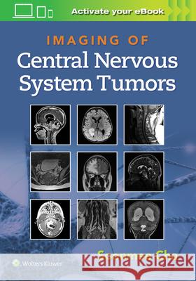 Imaging of Central Nervous System Tumors Cha, Soonme 9781975103743 LWW - książka