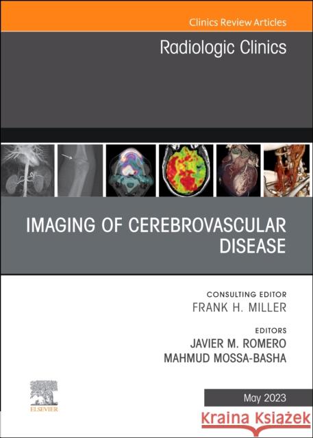 Imaging of Cerebrovascular Disease, An Issue of Radiologic Clinics of North America  9780323940092 Elsevier - Health Sciences Division - książka