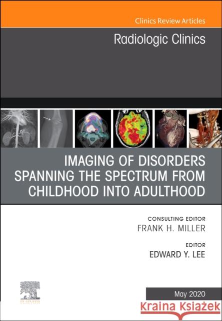 Imaging of Disorders Spanning the Spectrum from Childhood, an Issue of Radiologic Clinics of North America Edward Y. Lee 9780323711166 Elsevier - książka