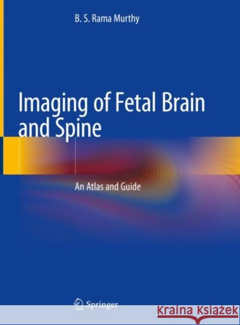 Imaging of Fetal Brain and Spine: An Atlas and Guide Rama Murthy, B. S. 9789811358432 Springer - książka