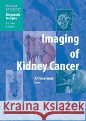 Imaging of Kidney Cancer Ali Guirmazi A. L. Baert M. a. Bosniak 9783540211297 Springer - książka