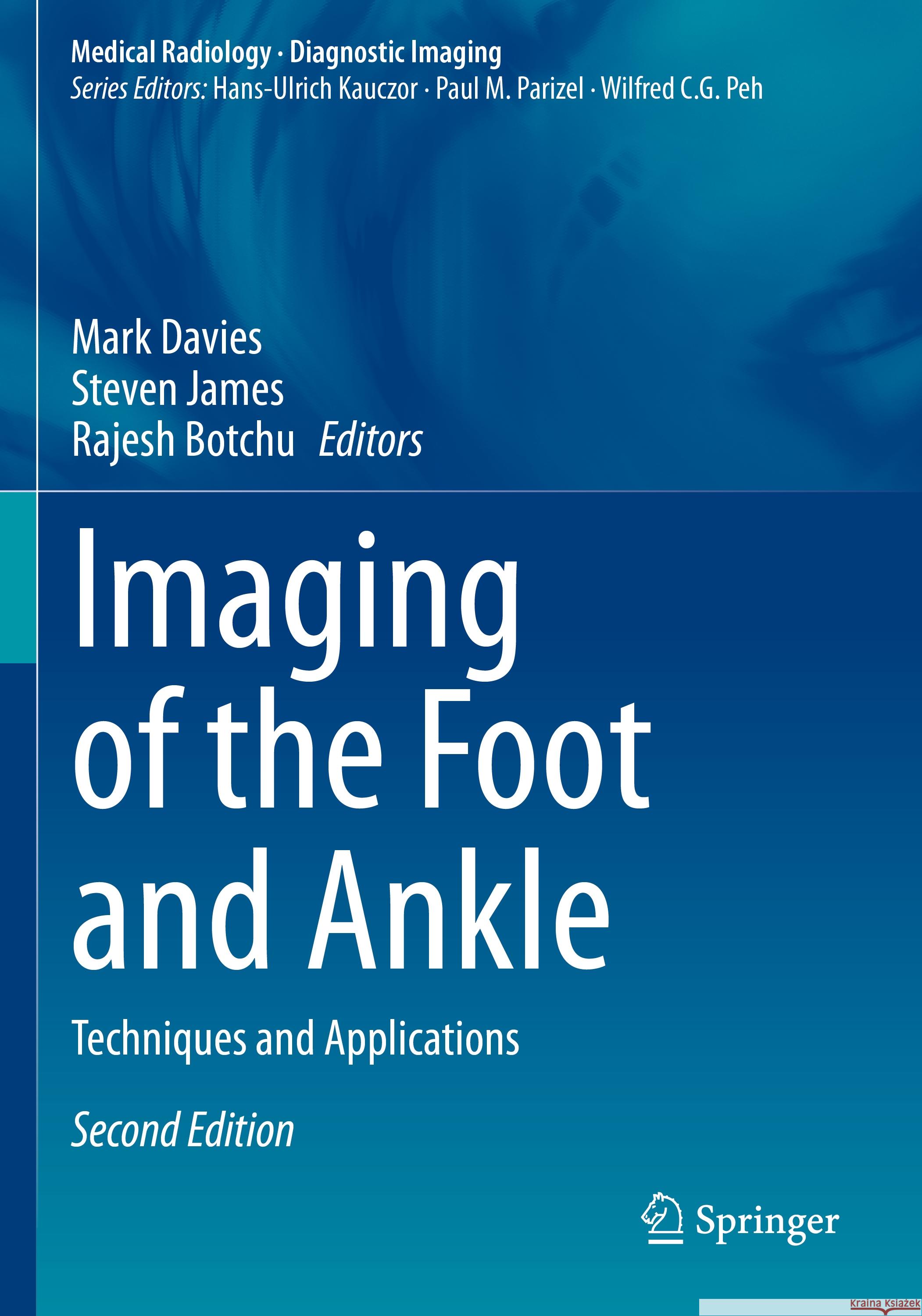 Imaging of the Foot and Ankle  9783031386114 Springer International Publishing - książka