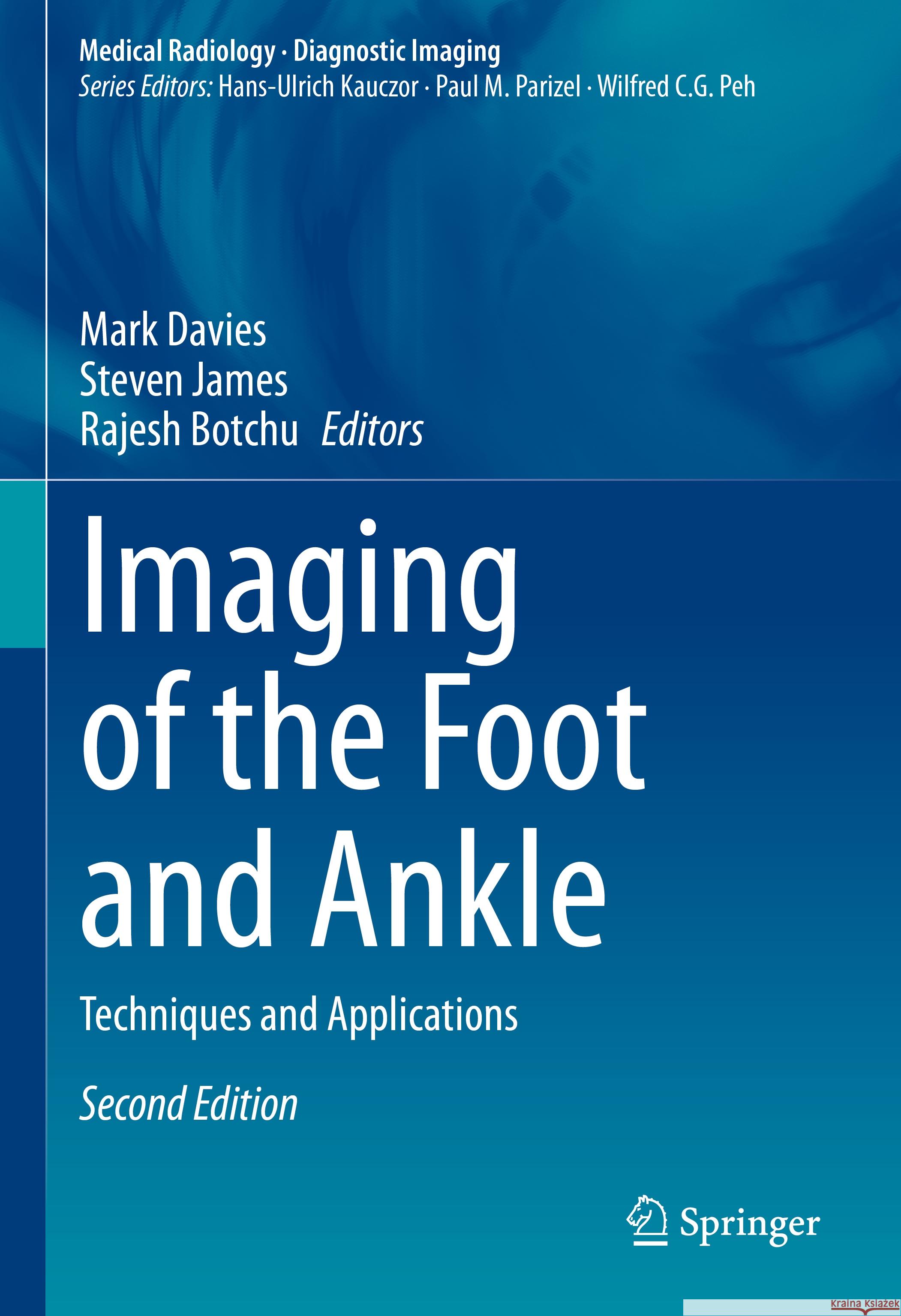 Imaging of the Foot and Ankle: Techniques and Applications Mark Davies Steven James Rajesh Botchu 9783031386084 Springer - książka