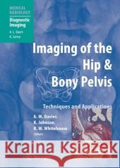 Imaging of the Hip & Bony Pelvis: Techniques and Applications Davies, A. Mark 9783642058400 Not Avail - książka
