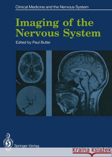 Imaging of the Nervous System Paul Butler 9781447116394 Springer - książka