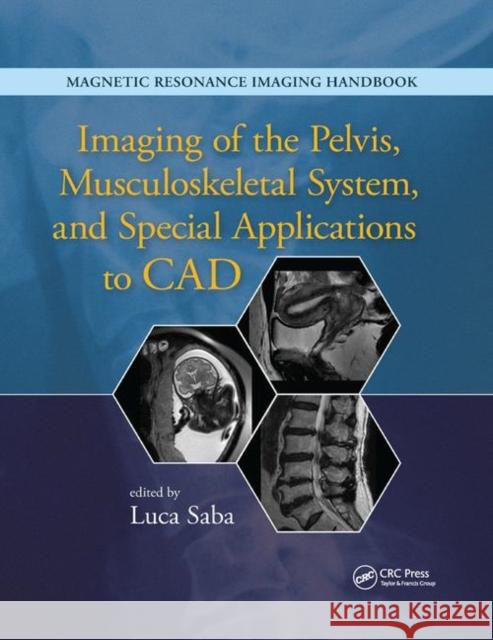 Imaging of the Pelvis, Musculoskeletal System, and Special Applications to CAD Luca Saba 9780367868901 CRC Press - książka