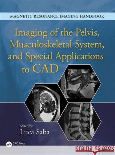 Imaging of the Pelvis, Musculoskeletal System, and Special Applications to CAD Luca Saba   9781482216219 Taylor and Francis - książka