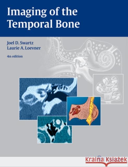 Imaging of the Temporal Bone J. D. Swart 9781588903457 Thieme Medical Publishers - książka