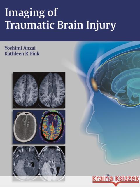 Imaging of Traumatic Brain Injury Yoshimi Anzai Kathleen R. Toze Kathleen R. Fink 9781604067286 Thieme Medical Publishers - książka